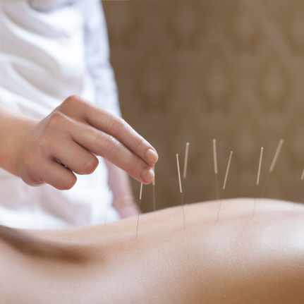 Acupuncture And Chiropractic Care Benefits