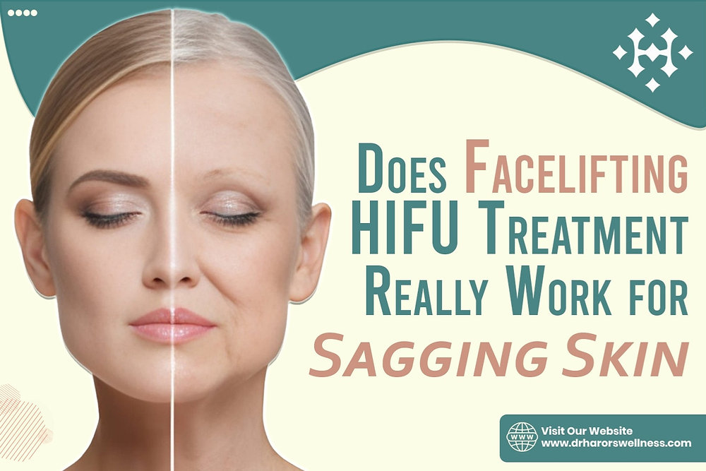 Does Facelifting HIFU Treatment Really Work for Sagging Skin?