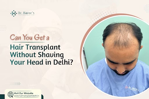 Can You Undergo a Hair Transplant Without Shaving Your Head in Delhi? : 2hairtransplant — LiveJournal