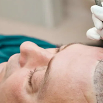 How to Finance a Hair Transplant: Loans, Payment Plans, and Insuranc...