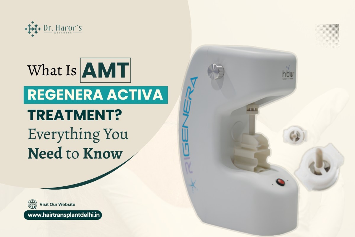 What Is AMT Rigenera Activa Treatment? Everything You Need to Know – hairtransplantclinicinidia