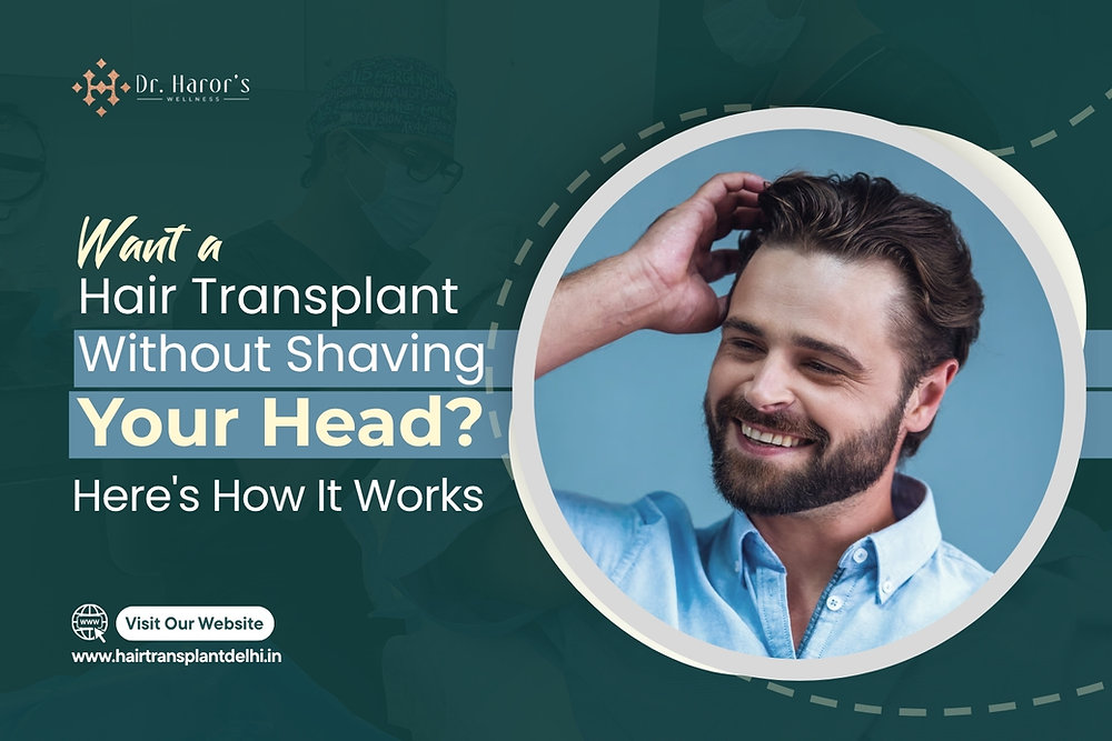 Want a Hair Transplant Without Shaving Your Head? Here's How It Works
