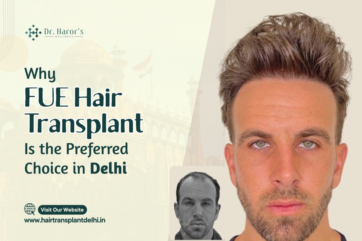 Why FUE Hair Transplant Is the Preferred Choice in Delhi – hairtransplantclinicinidia