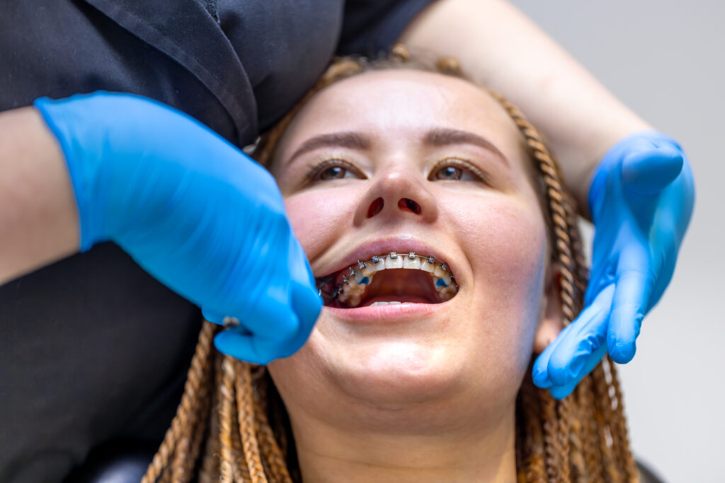 Traditional Braces in Georgetown, CT | Georgetown Ortho