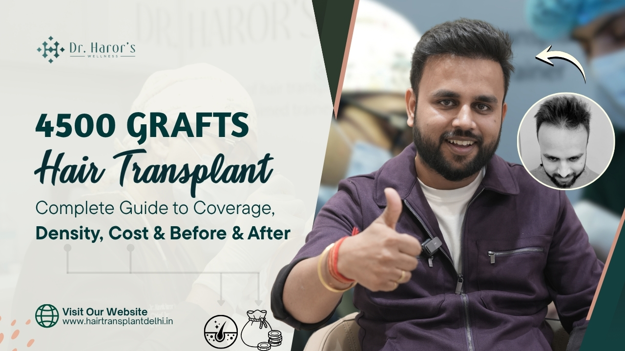 4500 Grafts Hair Transplant: Cost, Coverage & Results