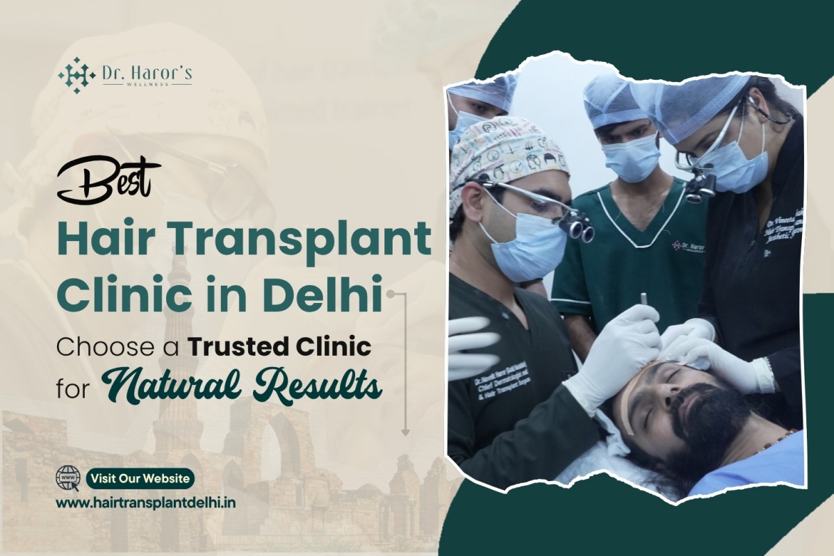Best Hair Transplant Clinic in Delhi: Choose a Trusted Clinic for Natural Results – hairtransplantclinicinidia