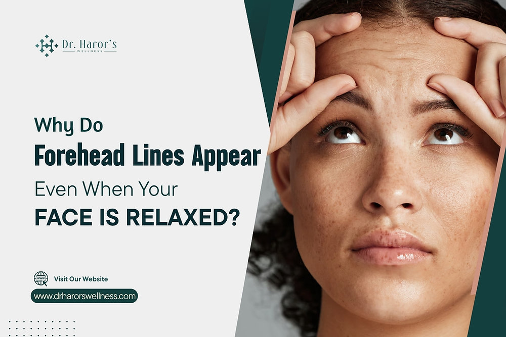 Why Do Forehead Lines Appear Even When Your Face Is Relaxed?