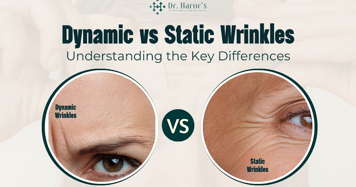 Dynamic vs Static Wrinkles: Understanding the Key Differences