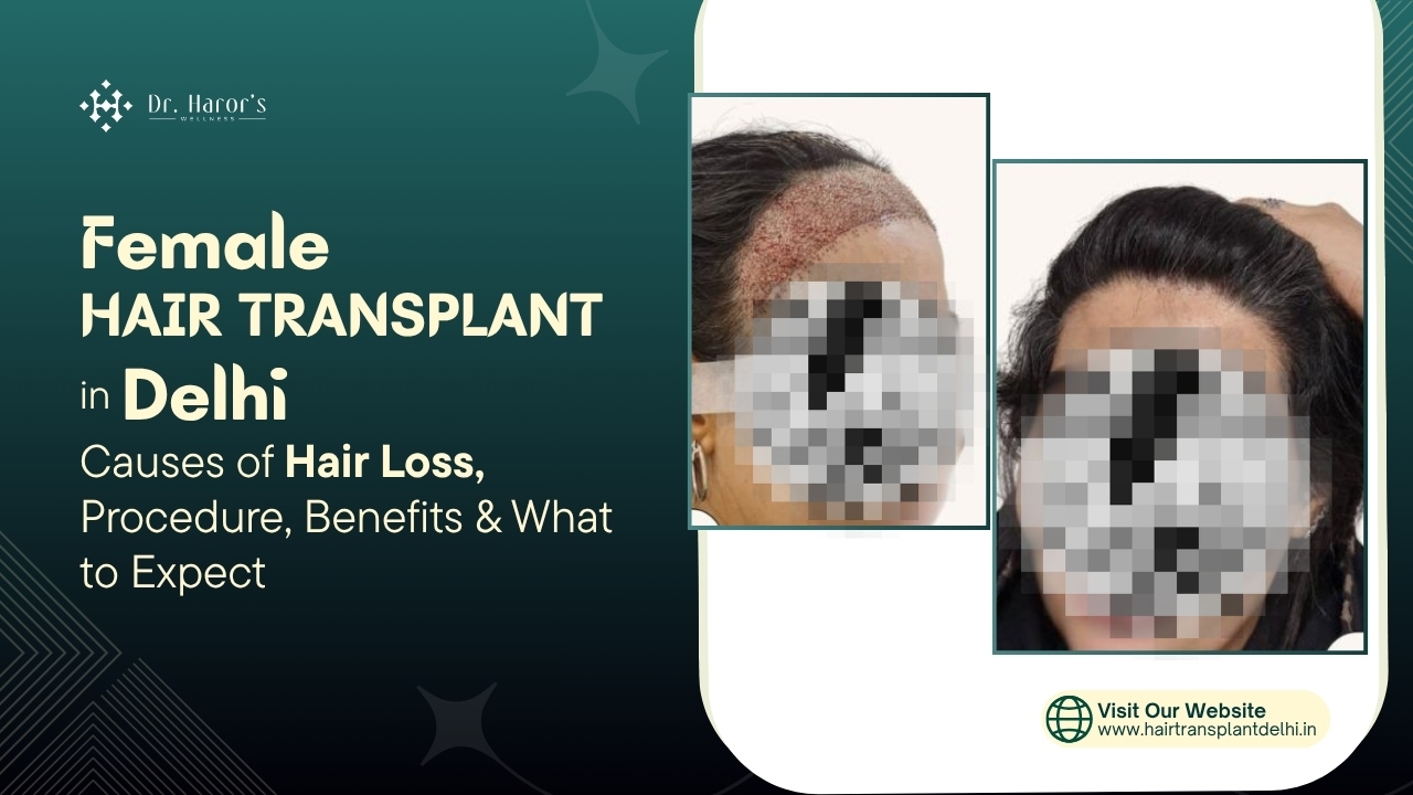 Female Hair Transplant in Delhi | Procedure, Results & Benefits