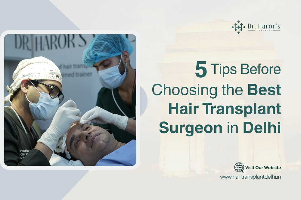 5 Tips Before Choosing the Best Hair Transplant Surgeon in Delhi