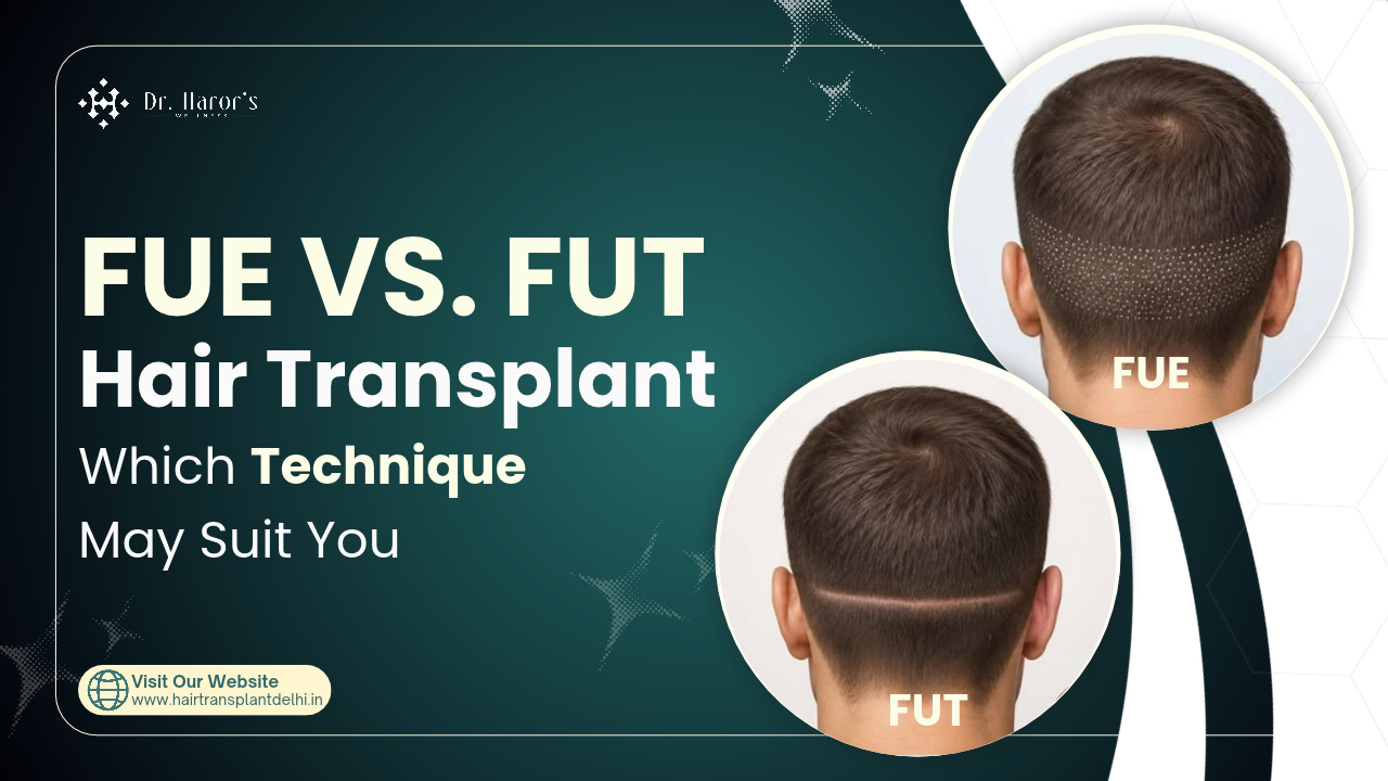 FUE vs. FUT Hair Transplant: Which Is Better?